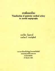 การศึกษาเรื่อง Visualization of posterior cerebral artery in carotid angiography