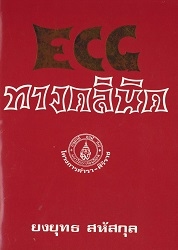 ECG ทางคลินิค