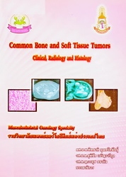 Common bone and soft tissue tumors : clinical, radiology and histology