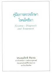 คู่มือการตรวจรักษาโรคเอ็คซีมา