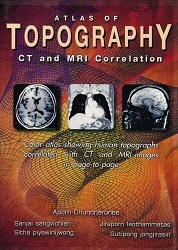 Atlas of topography CT and MRI correlation