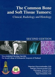 The common bone and soft tumors : clinical, radiology and soft tissue tumors : clinical, radiology and histology