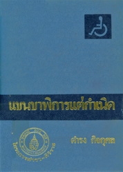 แขนขาพิการแต่กำเนิด