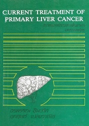 Current treatment of primary liver cancer