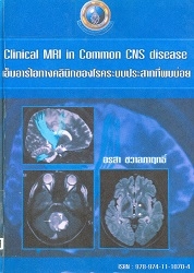 Clinical MRI in common CNS disease