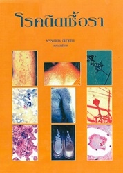โรคติดเชื้อรา