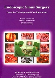 Endoscopic sinus surgery : operative techniques and case illustrations