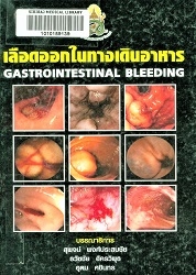 เลือดออกในทางเดินอาหาร
