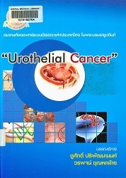 Urothelial cancer