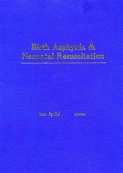 Birth asphyxia & neonatal resuscitation