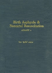 Birth asphyxia & neonatal resuscitation