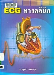 ECG ทางคลินิก