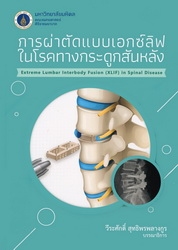 การผ่าตัดแบบเอกซ์ลิฟในโรคทางกระดูกสันหลัง