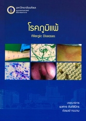 โรคภูมิแพ้