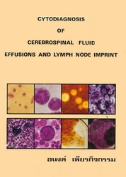 Cytodiagnosis of cerebrospinal fluid : effusions and lymph node imprint