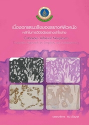 เนื้องอกและมะเร็งของรยางค์ผิวหนัง : หลักในการวินิจฉัยอย่างเข้าใจง่าย