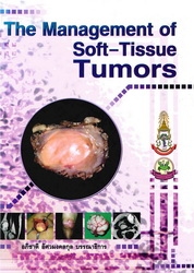The management of soft-tissue tumors