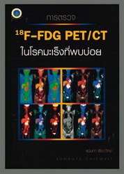 การตรวจ 18F-FDG PET/CT ในโรคมะเร็งที่พบบ่อย