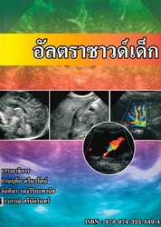 อัลตราซาวด์เด็ก
