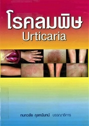 โรคลมพิษ = Urticaria