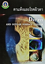 ตาแห้งและโรคผิวตา