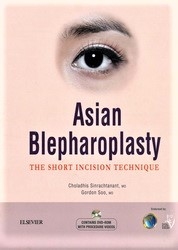 Asian blepharoplasty : the short incision techniques