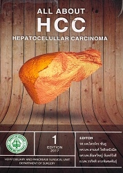 All about HCC hepatocelullar carcinoma